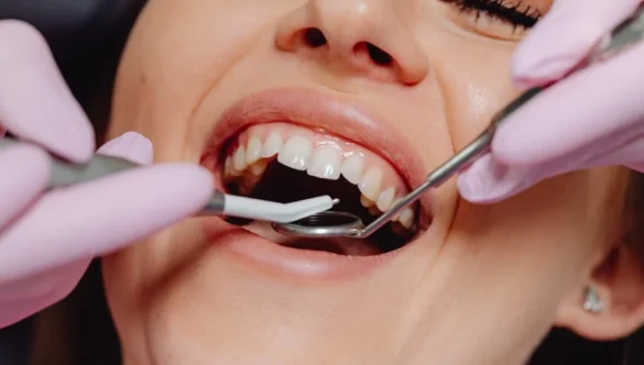 The Truth Behind the Hollywood Smile: What Instagram Won’t Tell You
