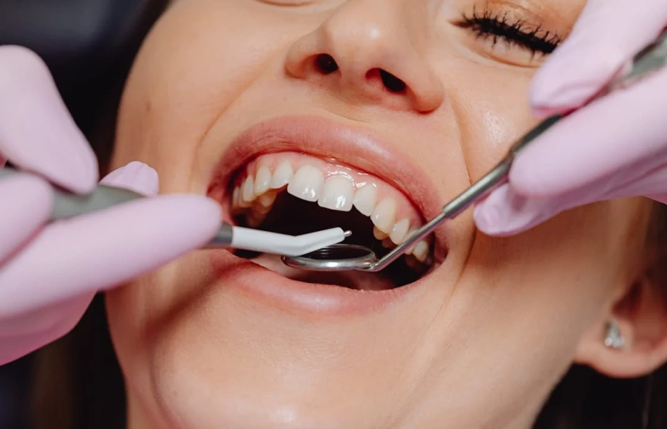The Truth Behind the Hollywood Smile: What Instagram Won’t Tell You