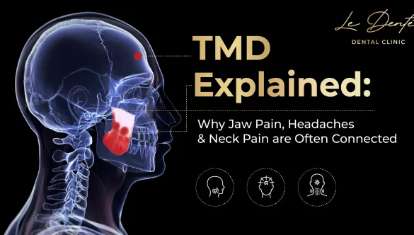 TMD Explained: Jaw Pain, Headaches & Neck Pain Causes & Treatment