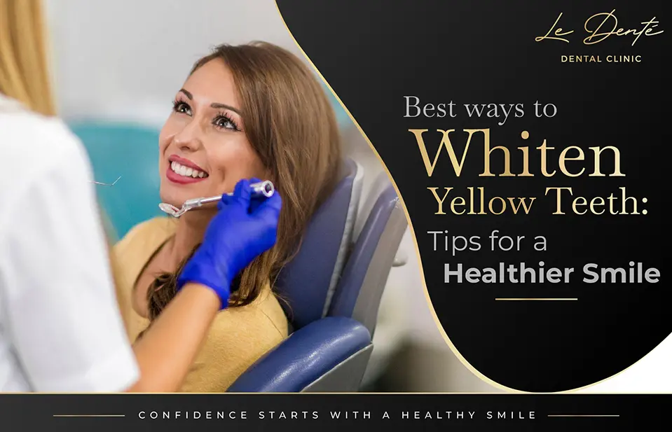 Best Ways to Whiten Yellow Teeth: Tips for a Healthier Smile
