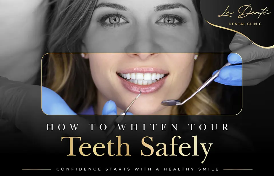 How To Whiten Your Teeth Safely