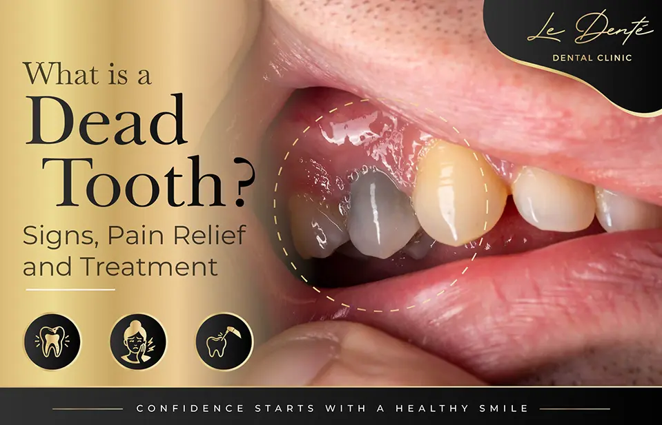 What Is a Dead Tooth? Signs, Pain Relief and Treatment
