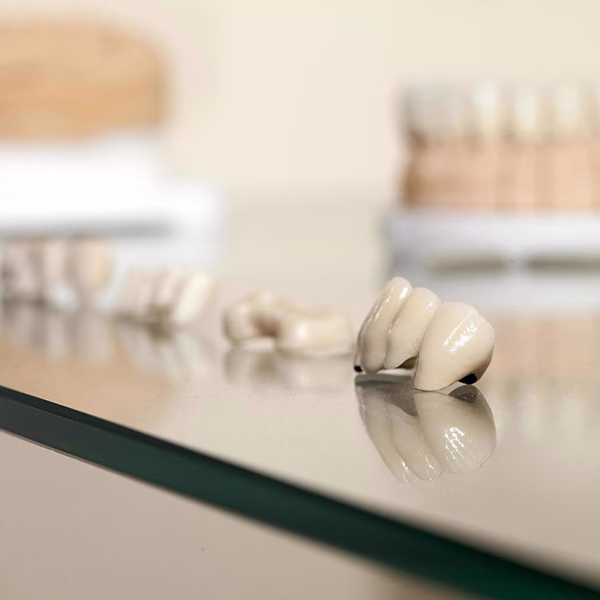 Benefits of Dental Implants