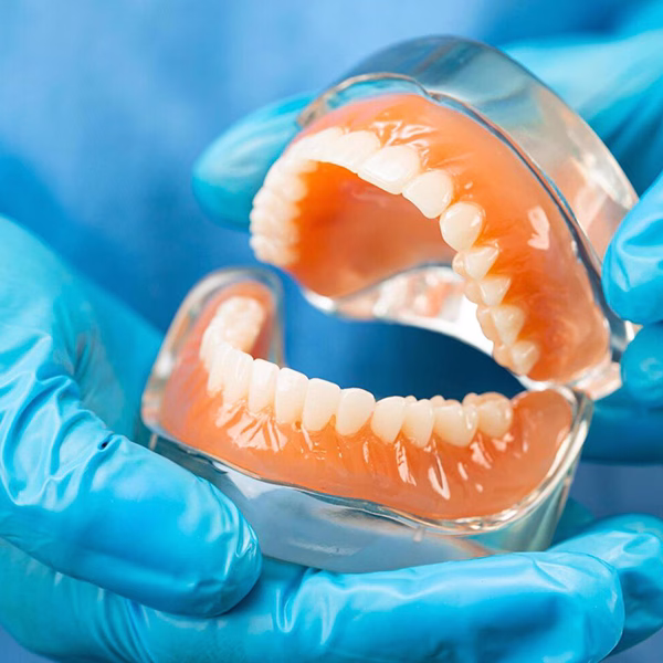 Dental Crowns and Bridges Treatment