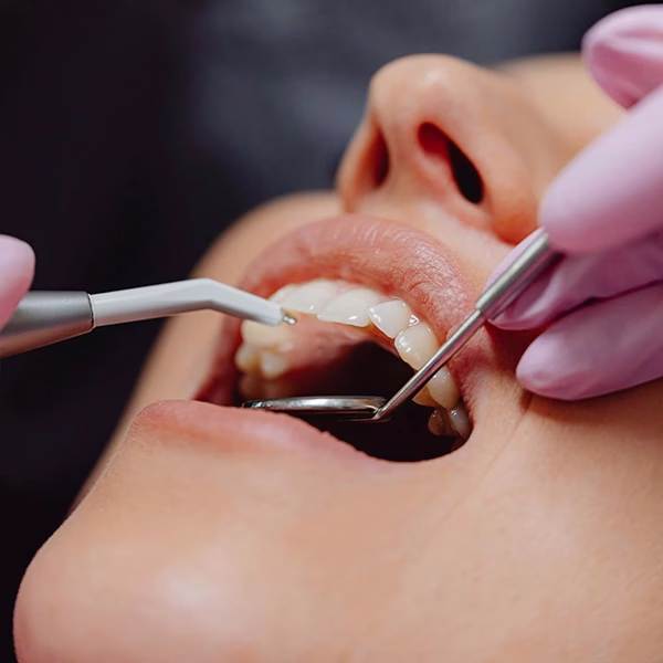 Why Choose dental implant