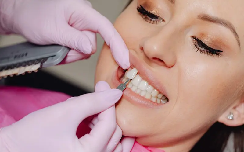 Porcelain vs. Ceramic Veneers