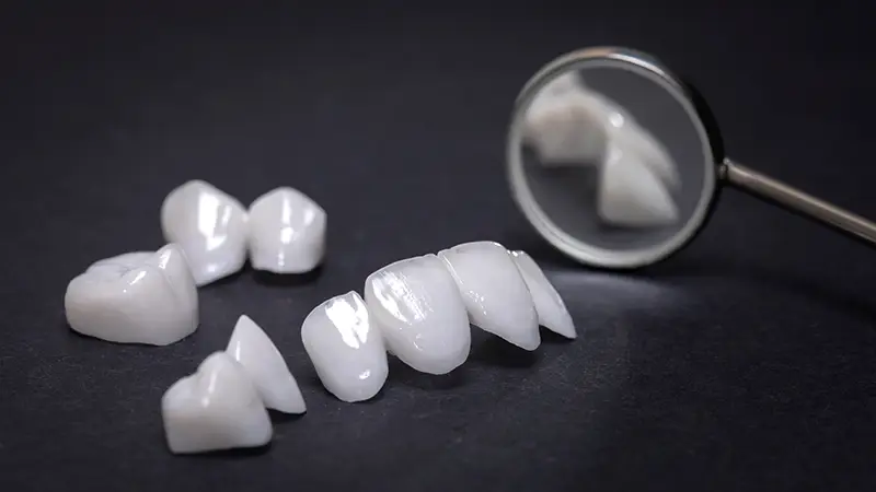 Porcelain Veneers