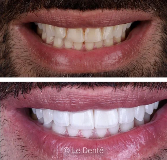 Smile makeover treatment result 10
